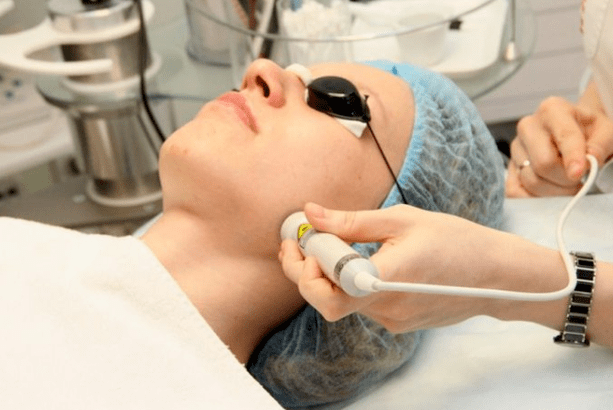 Laserbiorevitisierung